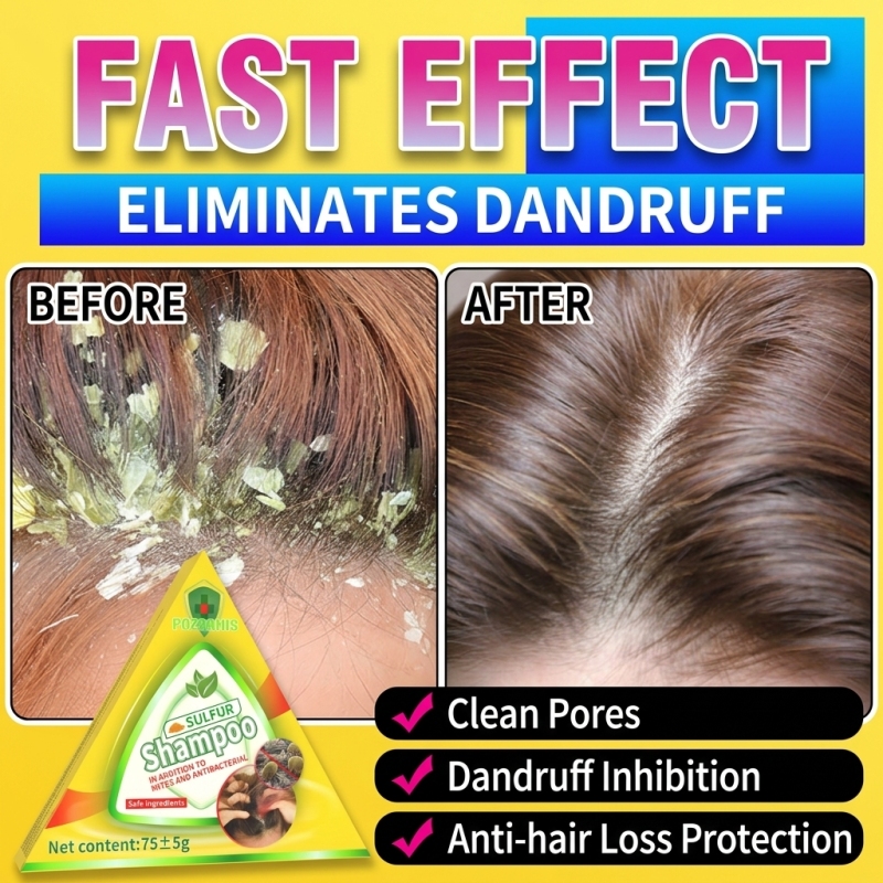Шампунь-бар для мужчин и женщи – обзор и цена Hair Care Dandruff