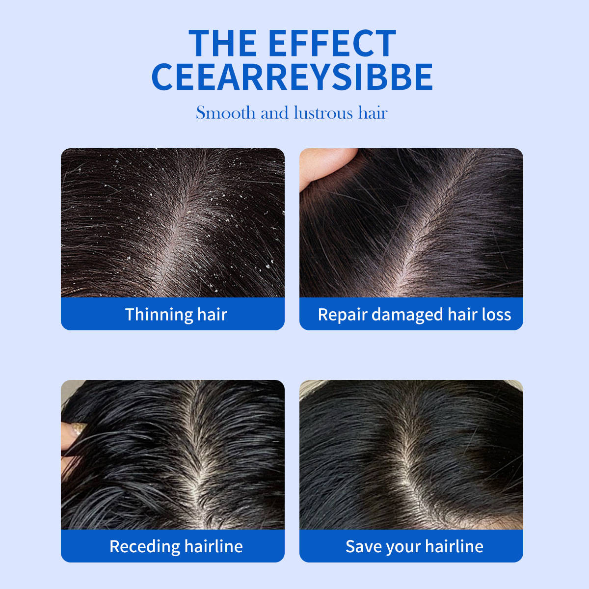 Шампунь против перхоти с дисул – обзор и цена Hair Care Dandruff